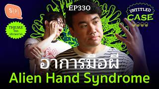 Alien Hand Syndrome: Who Is Controlling My Hand | Untitled Case EP330