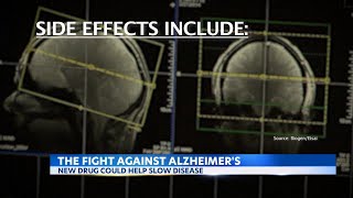New breakthrough in Alzheimer's drug