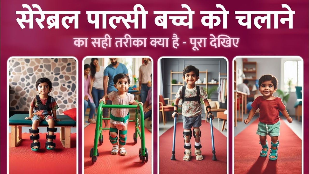 सेरेब्रल पाल्सी बच्चे को चलाने का सही तरीका क्या है-पूरा देखिये #physiotherapy #cerebralpalsy