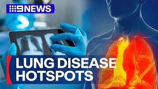 Worst lung disease hotspots in the nation revealed | 9 News Australia