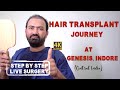 Journey of hair transplant at genesis hair transplant centre indore  step by step  best in indore