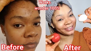 Do This Now To Clear Dark Spots, Reduce The Signs Of Aging And Look Younger Than Your Age.