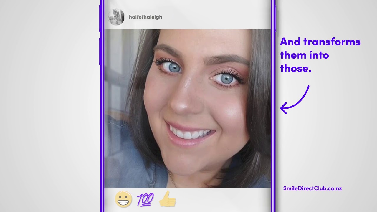 Straighten your smile for up to 60% less than braces* | Clear aligners | SmileDirectClub N - Straighten your smile for up to 60% less than braces* | Clear aligners | SmileDirectClub NZ