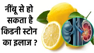 Kidney Stone का इलाज Lemon से हो सकता है क्या ? । Lemon Can Cure Kidney Stone | Boldsky screenshot 2