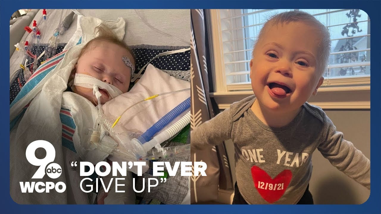 Baby with congenital heart defect defies odds - YouTube