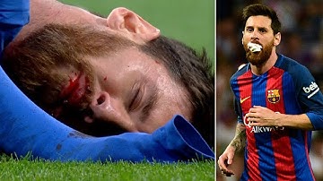 Lionel Messi BLEEDING in El CLASICO After Marcelo  Foul  Real Madrid vs Barcelona 2017 El Clasico