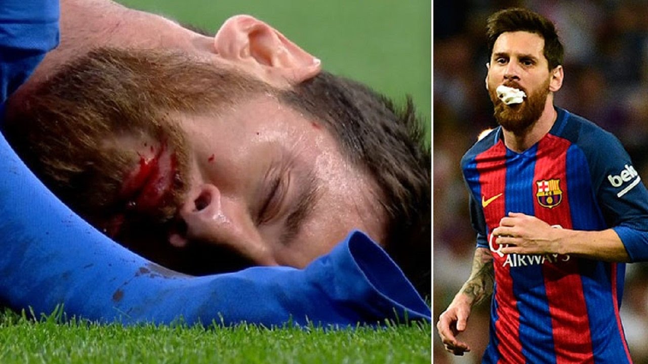 Lionel Messi BLEEDING in El CLASICO After Marcelo Foul Real Madrid vs