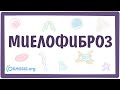 Миелофиброз — причины, симптомы, патогенез, диагностика, лечение