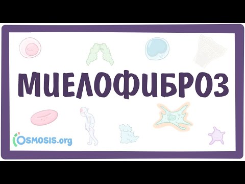 Видео: Лечение на миелофиброза: лекарства и др