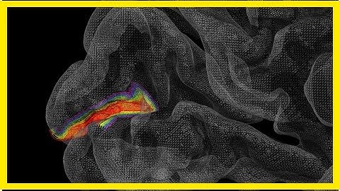 Breaking News | Theory of predictive brain as important as evolution – Prof. Lars Muckli