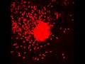 Collateral tissue damage due to neutrophil swarming part 1