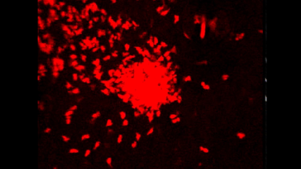 Collateral tissue damage due to neutrophil swarming part 1 - YouTube