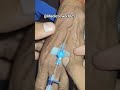 Iv cannula insertion in hand #medicoworld #doctor #medicine #healthcare #hospital #clinicalskills