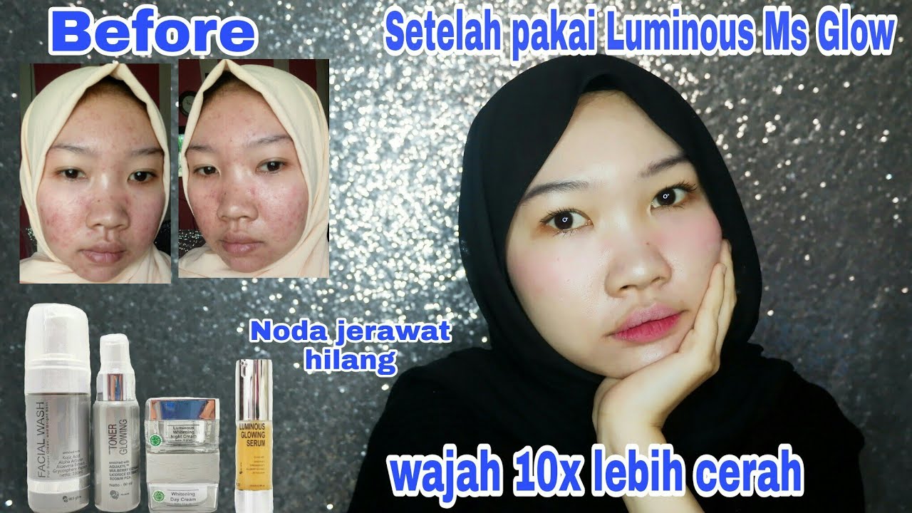 REVIEW PAKET LUMINOUS & SERUM LUMINOUS MS GLOW 