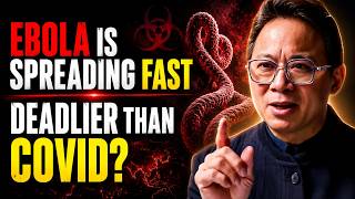 Doctors Warn: Early Ebola Symptoms Most People Ignore | Dr. William Li