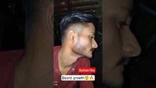 beard growth😲🔥🔥#beard #beardgrowth #minoxidil #foryou #viral #shorts #shortvideo