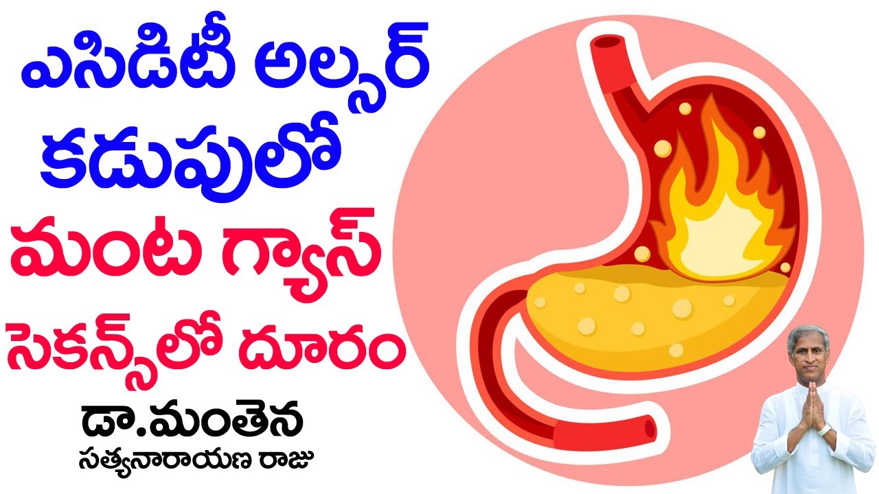 Gastroesophageal Reflux Disease GERD | Acidity, Ulcer | Dr Manthena Satyanarayana Raju | GOOD HEALTH