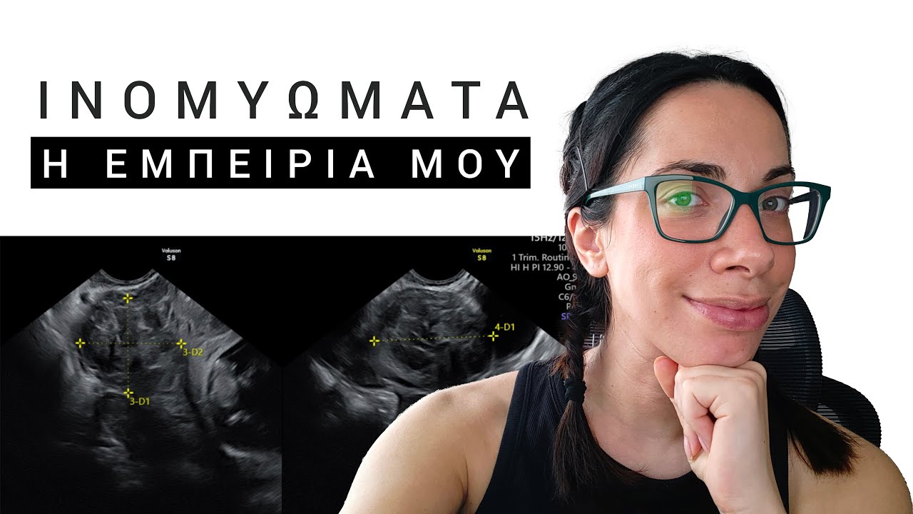 Ινομυώματα μήτρας: Η εμπειρία μου | Γιατί δεν μας ενημερώνει κανένας?