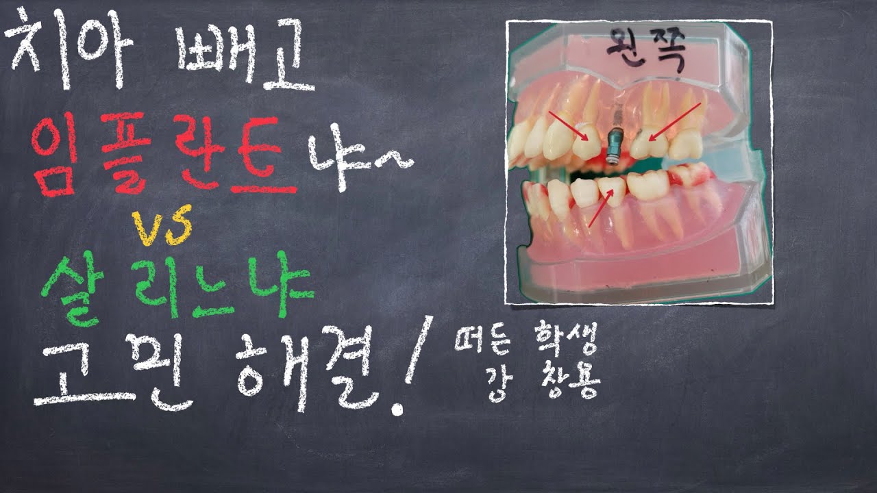 뷰티풀마인드 -영화 '록키 발보아'_인생은 얼마나 세게 치느냐가 아니야, 인생은 얼마나 세게 맞고도 나아갈 수 있는지야