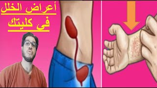 اعراض فشل الكلى | علامات تدل على مرض الكلي | اسباب خلل الكليتين | عوارض قصور الكلية في جسم الانسان