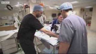 Bionic feet for amputee cat