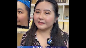 Combo Nâng Mũi + Cắt Mí Sau 10 Ngày