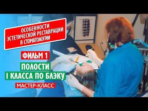 Фильм 1. Полости I класса по Блэку.