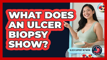What Does An Ulcer Biopsy Show? - Ulcer Support Network