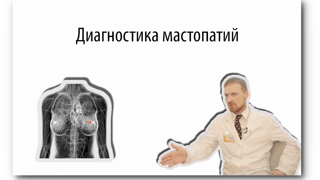 Мастопатии и кисты - диагностика: УЗИ, маммография, пункция, биопсия