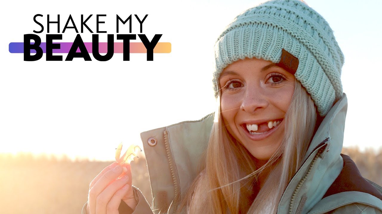 Making It As A Model - Despite My Missing Teeth | SHAKE MY BEAUTY