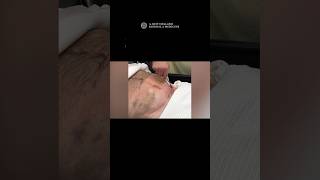 Videos in Clinical Medicine: Placement of a Catheter for Acute Peritoneal Dialysis (Overview)