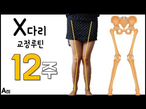 호주 물리치료사의 X다리 교정 루틴 (12주 루틴)