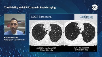 TrueFidelity and GSI XTREAM in Body Imaging, Dr. Nakul GUPTA