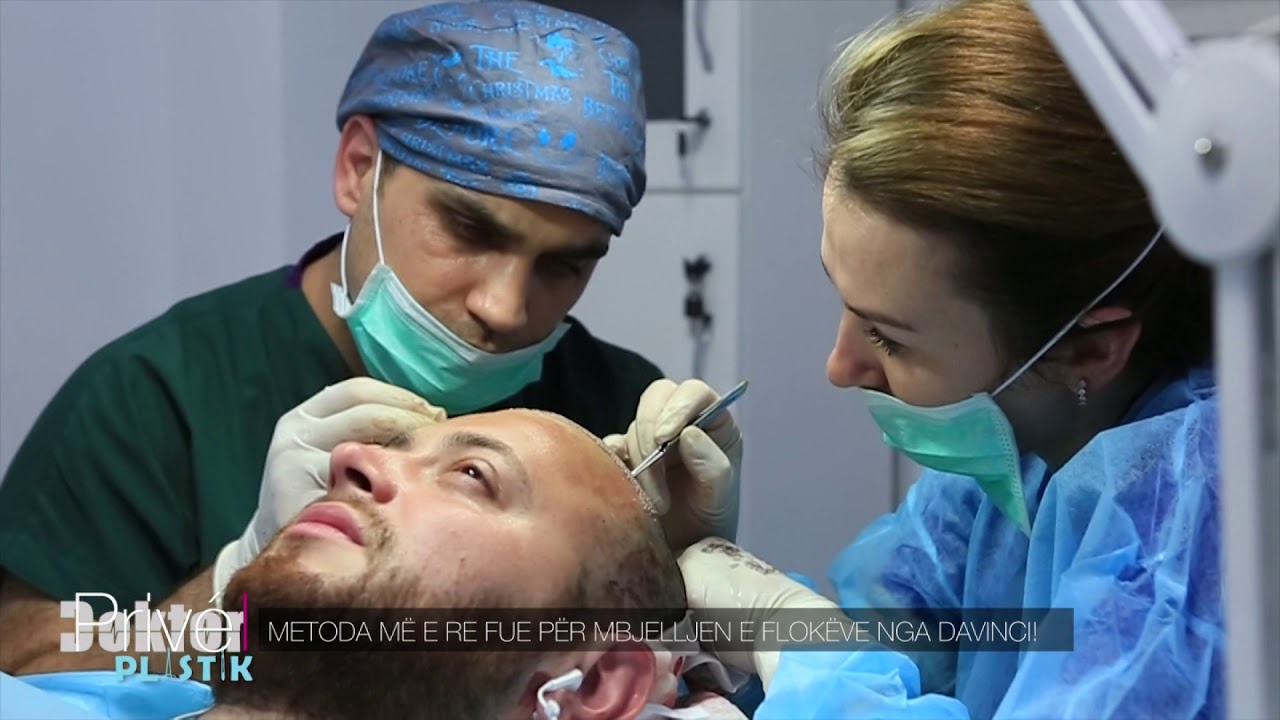 Metoda më e re FUE për mbjelljen e flokëve nga DaVinci!