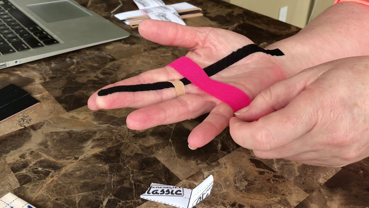 TRIGGER FINGER SCAR PAIN YouTube