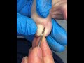 Satisfying Pedicure Routine | Gentle Toenail Care #fypシ #fypシ #pedicure #nailcare