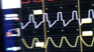 Waveform Analysis