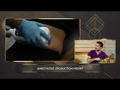 Vücutta biriken yağlara karşı ameliyatsız liposuction mucizesi!