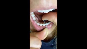 Orthodontist Responds: How To Floss With A Bonded Retainer 🦷 #shorts