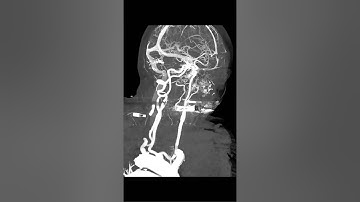 Converting DICOM to MP4 movie files: A proof of concept proposal.