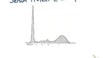 Che significa avere le proteine alte?