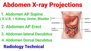Abdomen x-ray Projections# screenshot 5