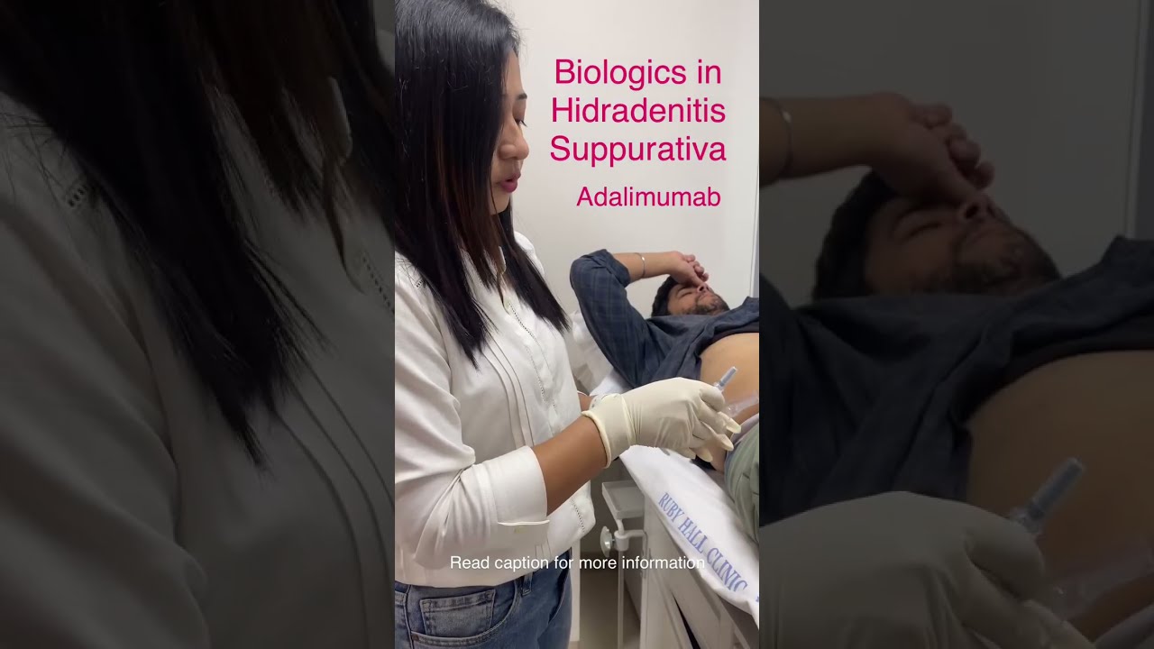 Adalimumab Biologics In Hidradenitis Suppurativa Dr Rashmi Aderao Skin Clinic