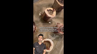 Is Bone Marrow Baby-Friendly?