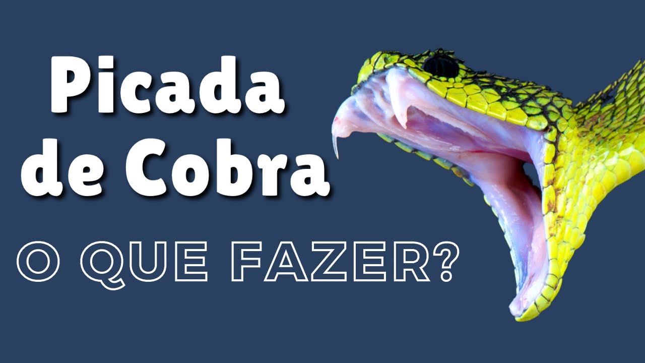 Curso (PICADA DE COBRA) – Primeiros Socorros (Butantan / Venenosa / Peçonhenta)