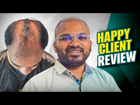 Happy Patient: 5000 Grafts Hair Transplant | Ch. Sambhaji Nagar/Aurangabad | New Roots