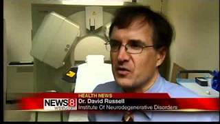 CT connection in Parkinson's study