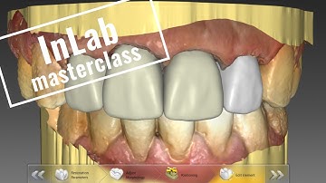 InLab Anterior Masterclass