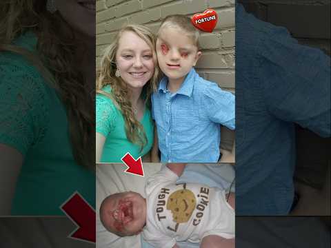 Tous lui ont dit d'avorter ce monstre, regardez ce qu'il est devenu 14 ans après