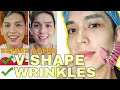 PAMPALIIT (V-SHAPE) NG FACE + TANGGAL WRINKLES? THREAD LIFTING PROCEDURE | SIR LAWRENCE